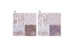 Immunohistochemical staining of human kidney, liver, skin and testis using Anti-GNL3 antibody HPA036743 (A) shows similar protein distribution across tissues to independent antibody HPA036742 (B).