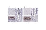 Immunohistochemical staining of human cerebral cortex, colon, eye, retina and testis using Anti-CRX antibody HPA036762 (A) shows similar protein distribution across tissues to independent antibody HPA036763 (B).