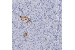 Immunohistochemical staining of human pancreas shows strong nuclear positivity in islets of Langerhans.