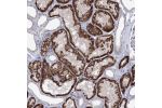 Immunohistochemical staining of human kidney shows strong granular cytoplasmic positivity in cells in tubules.