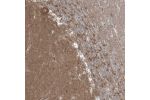 Immunohistochemical staining of human Cerebellum shows strong cytoplasmic positivity in Purkinje cells.