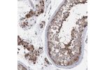 Immunohistochemical staining of human testis shows moderate to strong granular cytoplasmic positivity in cells in seminiferous ducts and Leydig cells.