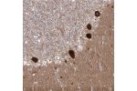 Immunohistochemical staining of human cerebellum shows strong cytoplasmic positivity in purkinje cells.