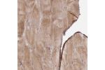 Immunohistochemical staining of human skeletal muscle shows cytoplasmic positivity in myocytes.