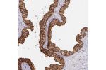 Immunohistochemical staining of human prostate shows strong cytoplasmic and membranous positivity in glandular cells.
