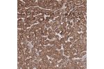 Immunohistochemical staining of human liver shows strong granular cytoplasmic positivity in hepatocytes.