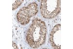 Immunohistochemical staining of human testis shows moderate nuclear and cytoplasmic positivity in cells in seminiferous ducts.