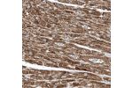 Immunohistochemical staining of human heart muscle shows strong cytoplasmic granular positivity in cardiomyocytes.