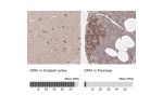 Immunohistochemistry analysis in human cerebral cortex and pancreas tissues using HPA036927 antibody. Corresponding OPA1 RNA-seq data are presented for the same tissues.