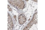 Immunohistochemical staining of human testis shows weak to moderate granular cytoplasmic positivity in cells in seminiferous ducts.