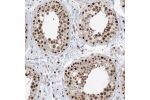 Immunohistochemical staining of human testis shows moderate nuclear positivity in cells in seminiferous ducts.