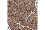 Immunohistochemical staining of human smooth muscle shows strong cytoplasmic positivity in smooth muscle cells.