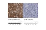 Immunohistochemistry analysis in human cerebral cortex and pancreas tissues using HPA037467 antibody. Corresponding SLC1A3 RNA-seq data are presented for the same tissues.