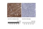 Immunohistochemistry analysis in human cerebral cortex and pancreas tissues using HPA037468 antibody. Corresponding SLC1A3 RNA-seq data are presented for the same tissues.