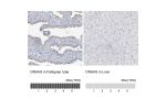 Immunohistochemistry analysis in human fallopian tube and liver tissues using HPA037470 antibody. Corresponding DNAH5 RNA-seq data are presented for the same tissues.