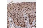 Immunohistochemical staining of human skin shows strong nuclear positivity in squamous epithelial cells.