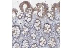 Immunohistochemical staining of human colon shows moderate cytoplasmic positivity in glandular cells.