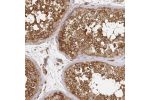 Immunohistochemical staining of human testis shows strong cytoplasmic positivity in cells in seminiferous ducts.