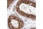 Immunohistochemical staining of human testis shows strong cytoplasmic positivity in cells in seminiferous ducts.