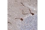 Immunohistochemical staining of human cerebellum shows strong cytoplasmic positivity in purkinje cells.