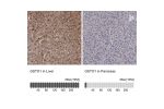 Immunohistochemistry analysis in human liver and pancreas tissues using HPA037603 antibody. Corresponding GSTO1 RNA-seq data are presented for the same tissues.