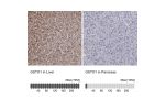 Immunohistochemistry analysis in human liver and pancreas tissues using HPA037604 antibody. Corresponding GSTO1 RNA-seq data are presented for the same tissues.