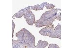 Immunohistochemical staining of human fallopian tube shows strong positivity in cilia in glandular cells.
