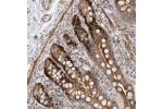 Immunohistochemical staining of human colon shows strong nuclear and cytoplasmic positivity in glandular cells.