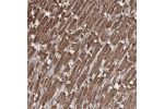 Immunohistochemical staining of human heart muscle shows strong granular cytoplasmic positivity in cardiomyocytes.