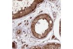 Immunohistochemical staining of human testis shows moderate to strong nuclear positivity in cells in seminiferous ducts.