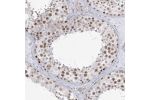 Immunohistochemical staining of human testis shows moderate nuclear positivity in cells in seminiferous ducts.
