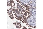Immunohistochemical staining of human colon shows moderate membranous positivity in glandular cells.