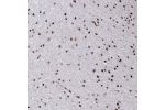 Immunohistochemical staining of human cerebral cortex shows strong nuclear positivity in neurons.