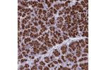 Immunohistochemical staining of human pancreas shows strong cytoplasmic positivity in exocrine glandular cells.