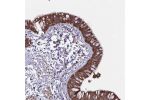 Immunohistochemical staining of human bronchus shows strong cytoplasmic and membranous positivity in respiratory epithelial cells.