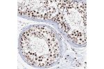 Immunohistochemical staining of human testis shows moderate to strong nuclear positivity in cells in seminiferous ducts.