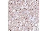 Immunohistochemical staining of human heart muscle shows strong nuclear positivity in cardiomyocytes.