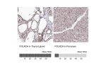 Immunohistochemistry analysis in human thyroid gland and pancreas tissues using Anti-POLR2H antibody. Corresponding POLR2H RNA-seq data are presented for the same tissues.