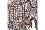 Immunohistochemical staining of human colon shows strong cytoplasmic and membranous positivity in glandular cells.