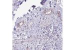 Immunohistochemical staining of human urinary bladder shows moderate positivity in endothelial cells.