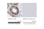 Immunohistochemistry analysis in human testis and cerebral cortex tissues using HPA037850 antibody. Corresponding HORMAD1 RNA-seq data are presented for the same tissues.