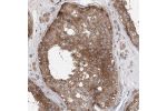 Immunohistochemical staining of human testis shows strong cytoplasmic positivity in cells in seminiferous ducts.