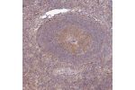 Immunohistochemical staining of human lymph node shows moderate cytoplasmic positivity in germinal center cells.