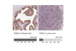 Immunohistochemistry analysis in human fallopian tube and liver tissues using Anti-PRDX5 antibody. Corresponding PRDX5 RNA-seq data are presented for the same tissues.