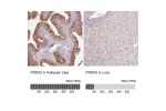 Immunohistochemistry analysis in human fallopian tube and liver tissues using Anti-PRDX5 antibody. Corresponding PRDX5 RNA-seq data are presented for the same tissues.
