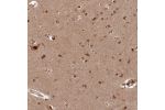 Immunohistochemical staining of human cerebral cortex shows moderate nuclear positivity in neuronal cells.