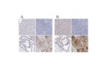 Immunohistochemical staining of human heart muscle, lymphoid tissues, placenta and skeletal muscle using Anti-NRAP antibody HPA037954 (A) shows similar protein distribution across tissues to independent antibody HPA037953 (B).