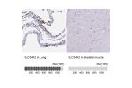 Immunohistochemistry analysis in human lung and skeletal muscle tissues using HPA037989 antibody. Corresponding SLC34A2 RNA-seq data are presented for the same tissues.