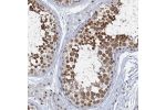 Immunohistochemical staining of human testis shows moderate to strong nuclear positivity in cells in seminiferous ducts.