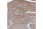Immunohistochemical staining of human skeletal muscle shows moderate cytoplasmic positivity in myocytes.